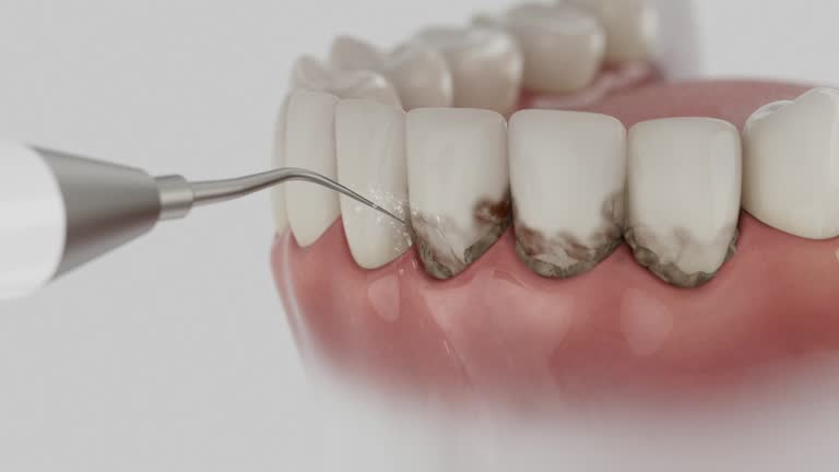 Reliable Dental Implants contractor in Lordstown, OH by Smile Center Dentistry
